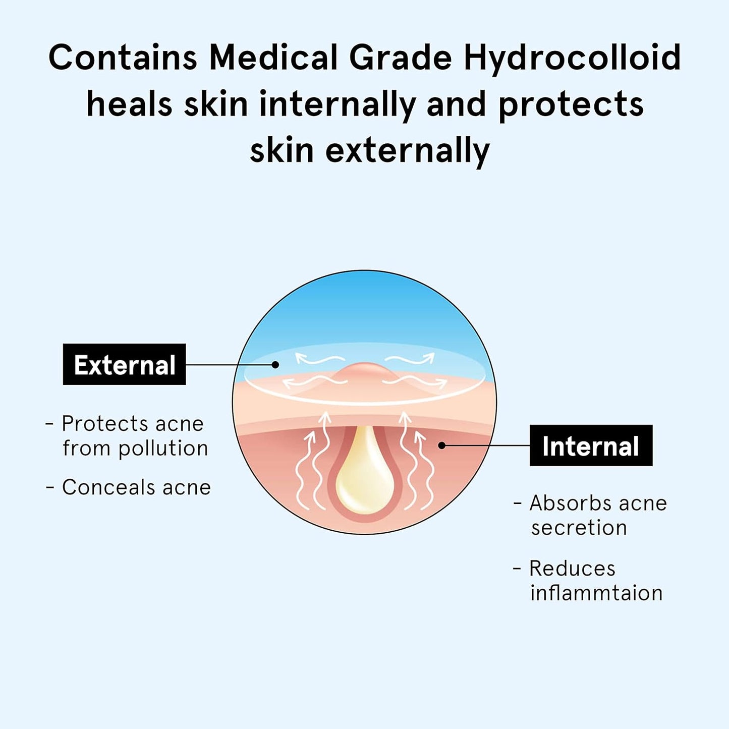 BeBodywise Hydrocolloid Acne Pimple Patch - 24 pcs
