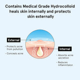 BeBodywise Hydrocolloid Acne Pimple Patch - 24 pcs