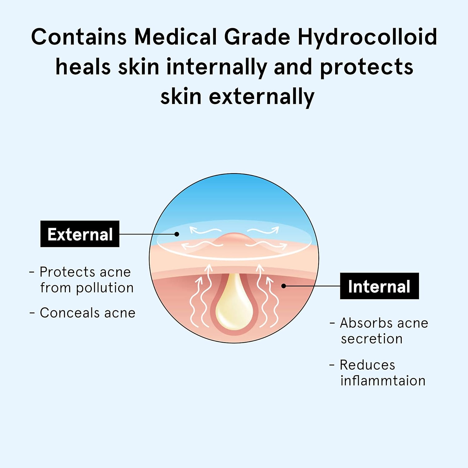 BeBodywise Hydrocolloid Acne Pimple Patch - 24 pcs