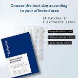 BeBodywise Hydrocolloid Acne Pimple Patch - 24 pcs