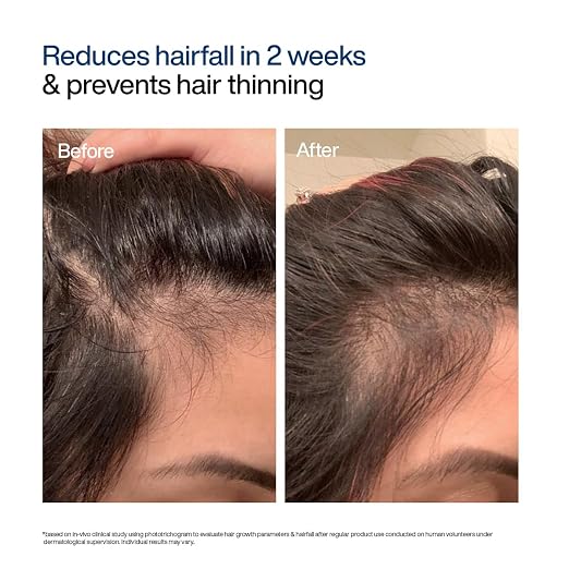 WishCare Hair Growth Serum Concentrate with Redensyl & Biotin 30ml | In-Vivo & In-Vitro Tested
