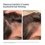 WishCare Hair Growth Serum Concentrate with Redensyl & Biotin 30ml | In-Vivo & In-Vitro Tested