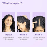 BeBodywise Anti Dandruff Hair Serum - 50 ml
