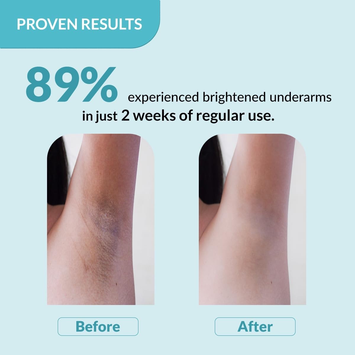 Fixderma Nigrifix Deodorant Underarm Roll-On 60ml AHA Brightening &amp; Exfoliating