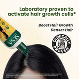 Sesa Ayurvedic Hair Oil for Hair Fall &amp; Hair Growth 100 Ml Free Shipping