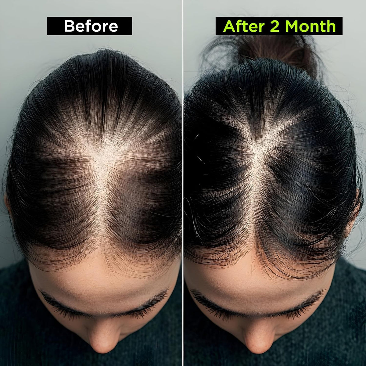 Health Veda Hair Vitamin Capsules DHT Blocker with Biotin Hair Growth 60 Veg Cap