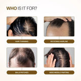 Advanced Hair Growth Serum Roll-On 25ML Reduces Hair Fall- FREE SHIPPING