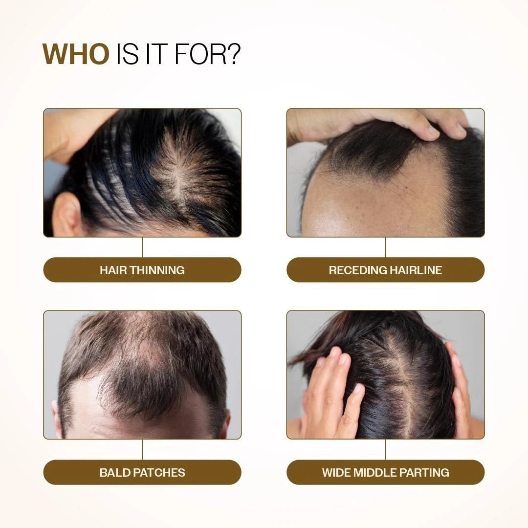 Advanced Hair Growth Serum Roll-On 25ML Reduces Hair Fall- FREE SHIPPING
