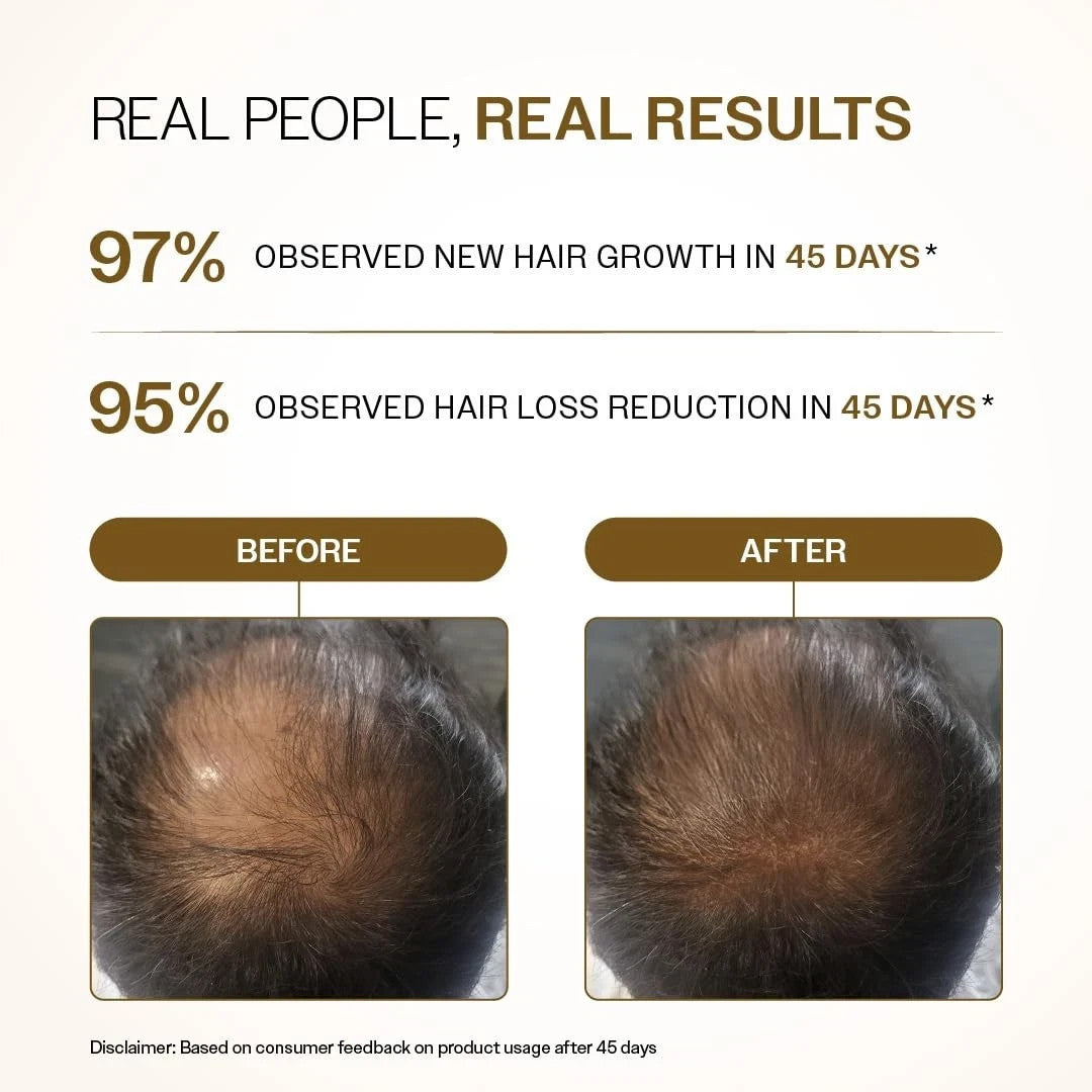 Advanced Hair Growth Serum Roll-On 25ML Reduces Hair Fall- FREE SHIPPING