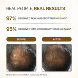 Advanced Hair Growth Serum Roll-On 25ML Reduces Hair Fall- FREE SHIPPING