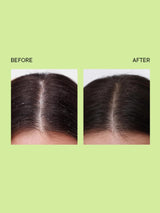 Quench Hair Serum 100ml for Dandruff Control with Tea Tree Extracts