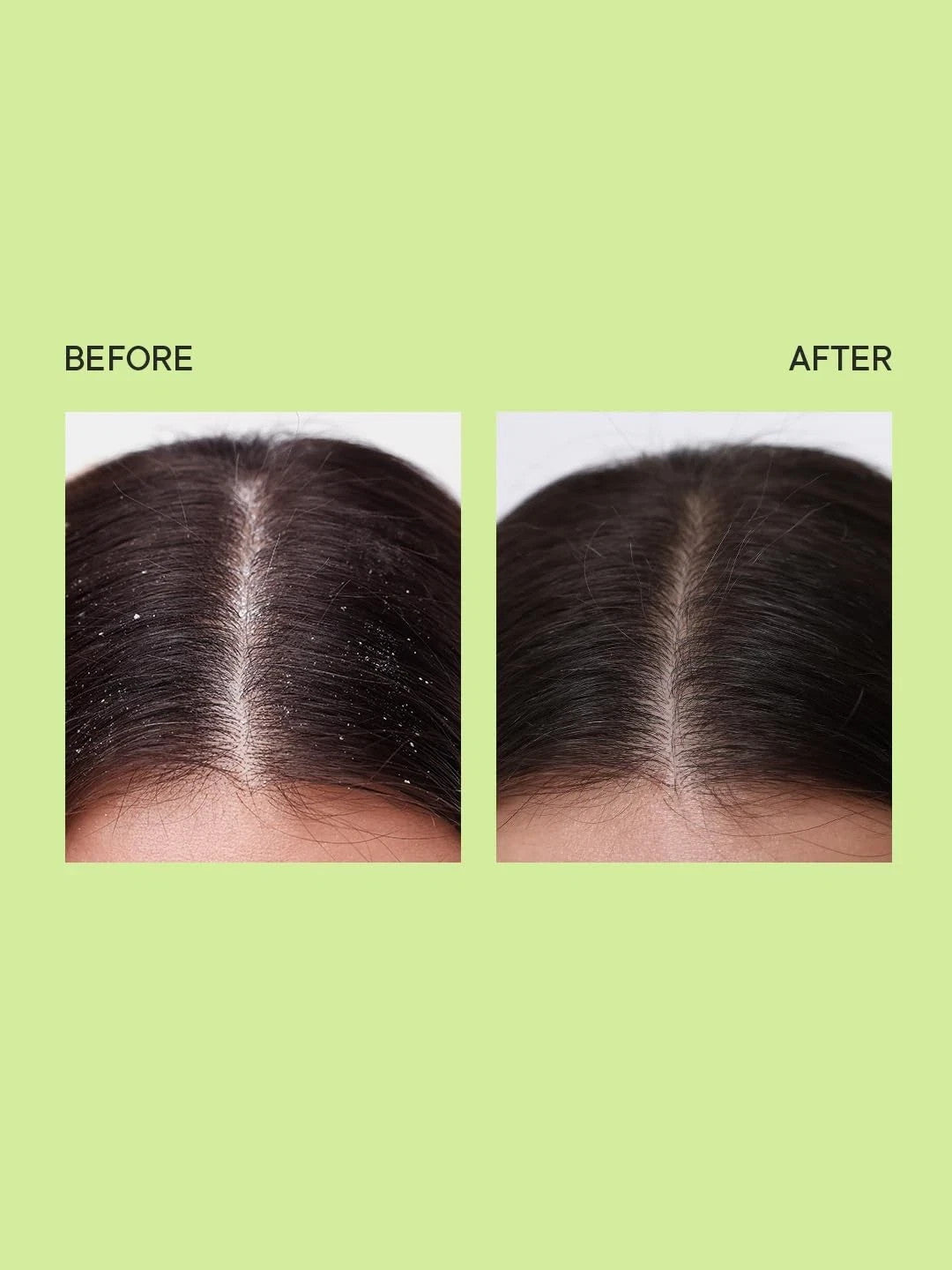 Quench Hair Serum 100ml for Dandruff Control with Tea Tree Extracts