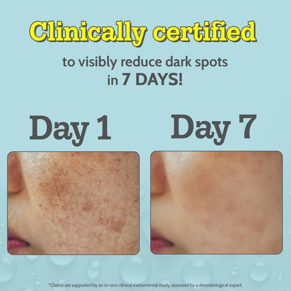 Chemist At Play 10% Vitamin C Serum 10ml Dark Spots &amp; Hyperpigmentat<wbr/>ion